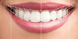 Smile Design